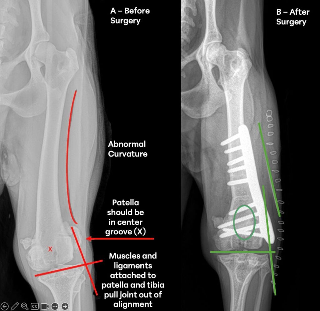 Before-and-after images of an 8-month-old dog with grade 4 patellar luxation and angular limb deformity following corrective surgery.