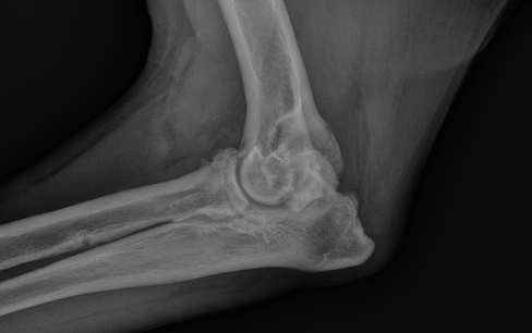 Radiograph of a 2-year-old dog showing moderate osteoarthritis of the elbow.